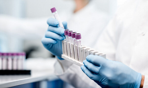 Rusia suministrará laboratorios móviles a Etiopía