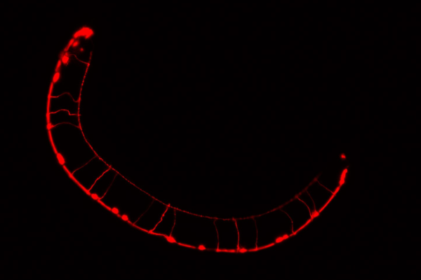 Argentina | Identifican cómo se vinculan ciertas mutaciones genéticas con alteraciones del neurodesarrollo