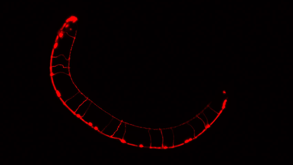 Argentina | Identifican cómo se vinculan ciertas mutaciones genéticas con alteraciones del neurodesarrollo
