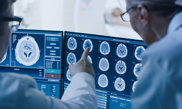 China presenta un avance revolucionario en la interfaz cerebro-ordenador con la primera prueba de implante inalámbrico