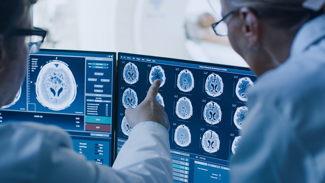 China presenta un avance revolucionario en la interfaz cerebro-ordenador con la primera prueba de implante inalámbrico